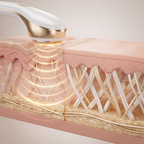 Luxèvia™️ - Dispositivo Viso Multiazione