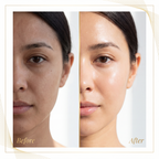 Luxèvia™️ - Dispositivo Viso Multiazione